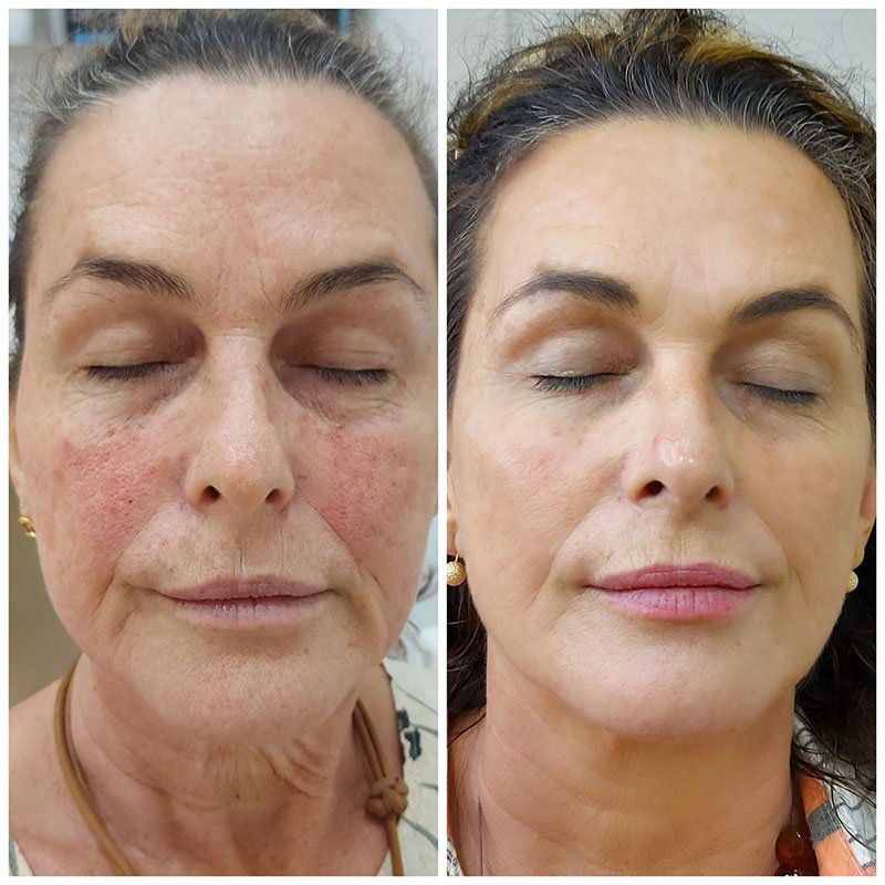 Sem Título-1_0000_WhatsApp Image 2025-07-08 at 12.29.26