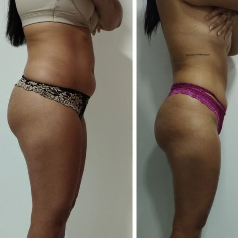 Sem Título-1_0003_WhatsApp Image 2025-07-08 at 12.31.14