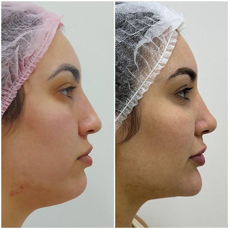 Sem Título-1_0005_WhatsApp Image 2025-07-08 at 12.17.00 (1)