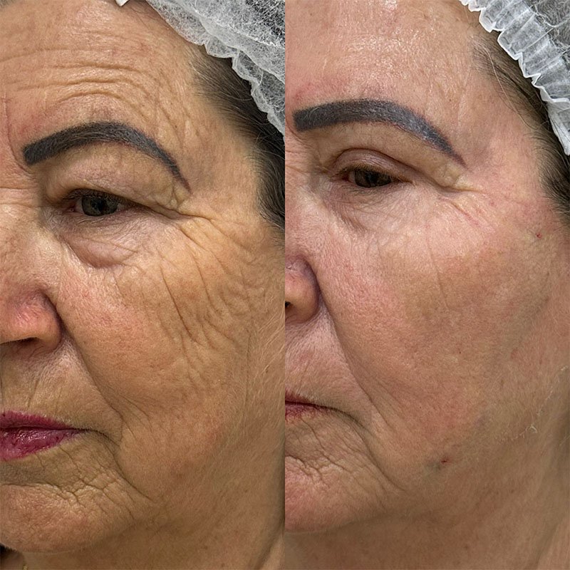 Sem Título-1_0007_WhatsApp Image 2025-07-08 at 12.29.25